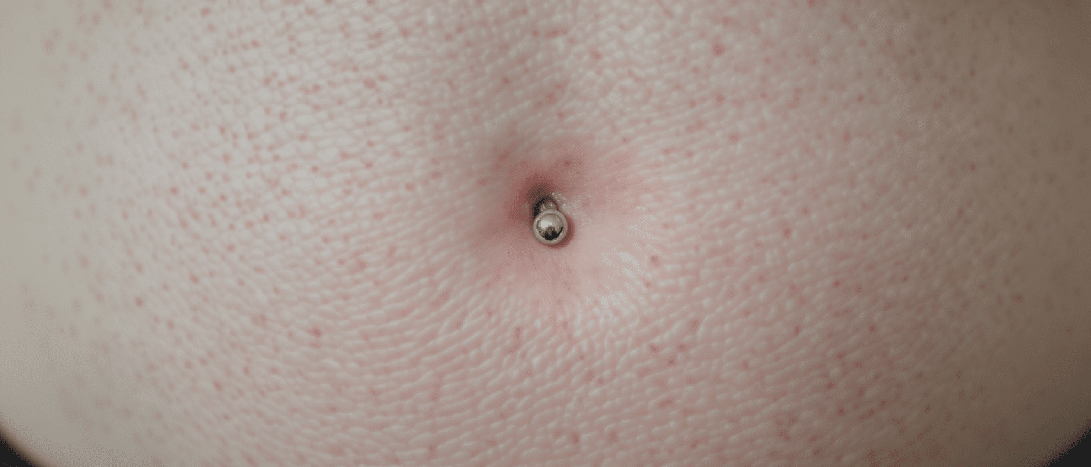 Rejet piercing nombril : signes, gestion et recommandations de soins