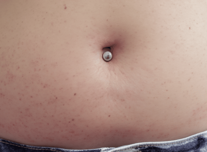 découvrez les signes de rejet d'un piercing au nombril, comment gérer cette situation délicate et nos recommandations pour des soins adaptés afin de préserver votre peau.