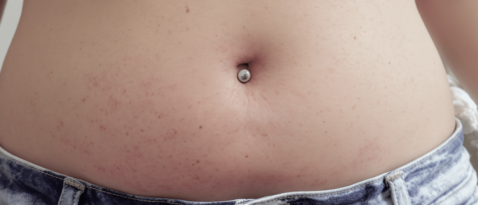 découvrez les signes de rejet d'un piercing au nombril, comment gérer cette situation délicate et nos recommandations pour des soins adaptés afin de préserver votre peau.