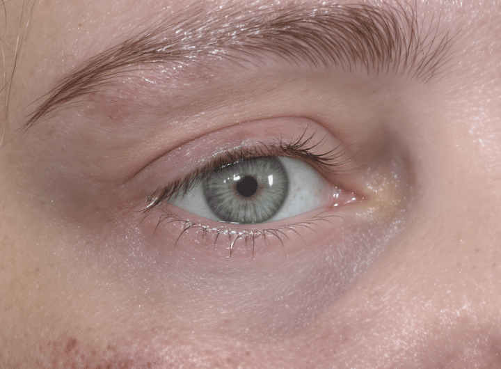 découvrez tout sur le piercing snake eyes : les différentes formes, les meilleurs emplacements et les précautions essentielles à prendre pour un piercing réussi et sans risques.